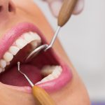 No olvides tu salud dental en las fiestas